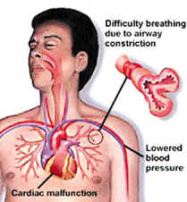 Anaphylactic Reaction